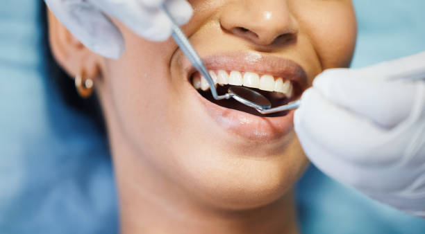 Best Emergency Dental Care for Broken or Chipped Teeth in Princeton, MO